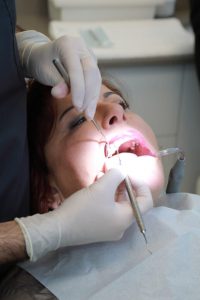 שן בינה ,מטופלת במרפאת השיניים של ד"ר אבנרי ליאור